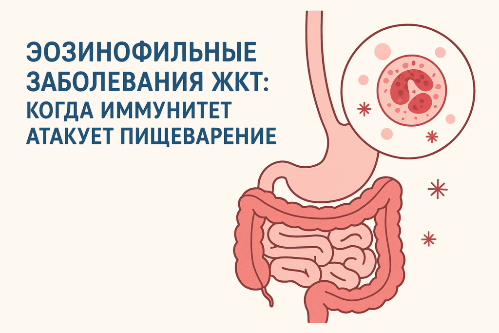 Эозинофильные заболевания ЖКТ