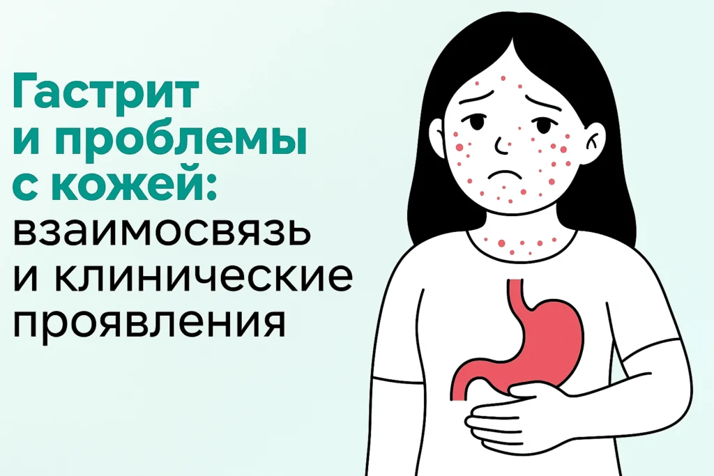 Гастрит и проблемы с кожей: взаимосвязь и клинические проявления Гастрит и проблемы с кожей: взаимосвязь и клинические проявления